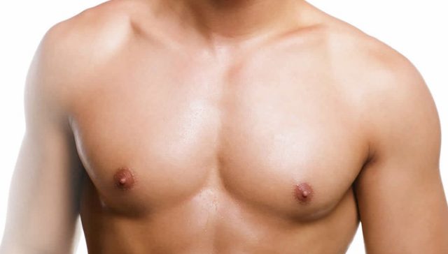إزالة التثدي عند الرجال