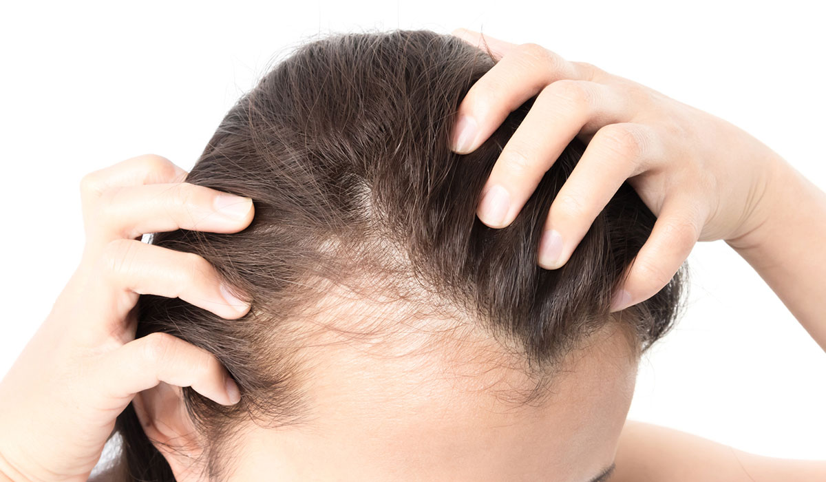 البلازما للشعر الخفيف .. لزيادة نمو الشعر بطريقة أكثر أمانًا
