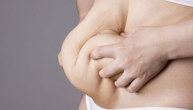 عملية شد البطن مع الولادة القيصرية