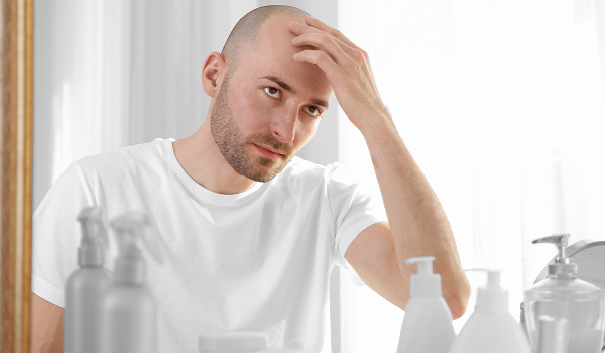 ما هي طرق علاج تساقط الشعر للرجال التي يمكن تجربتها؟