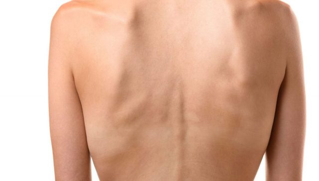 طرق زيادة الوزن بسرعة للنساء