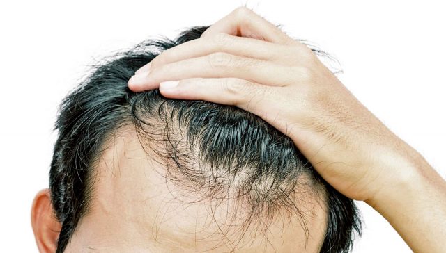 ادوية لعلاج تساقط الشعر