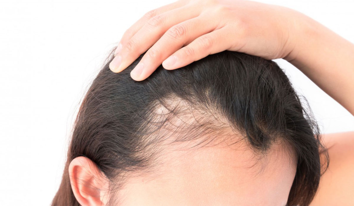الخلايا الجذعية للشعر.. أحدث طرق علاج التساقط.. وتحسين جودة وملمس الشعر