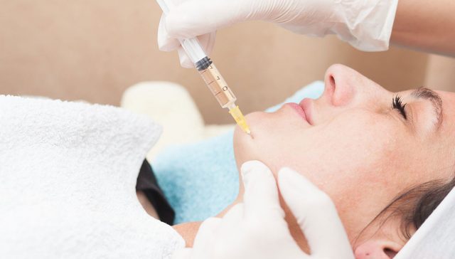 تجميل الذقن بالفيلر
