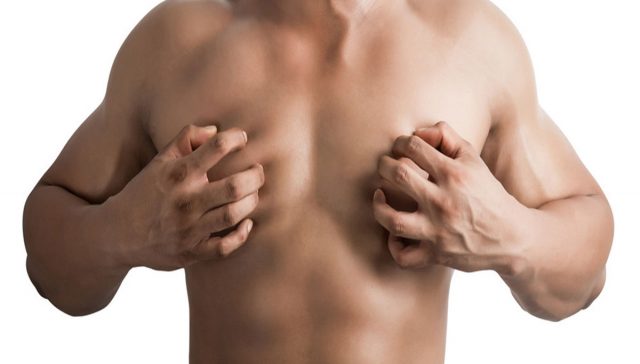 التثدي عند الرجال اسبابه وعلاجه