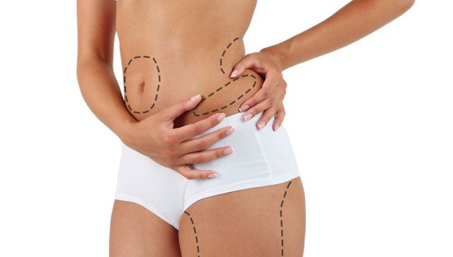 عمليات شد الجسم