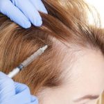 علاج طبيعي لتساقط الشعر