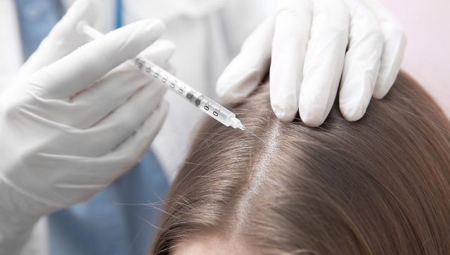 اسعار بلازما الشعر