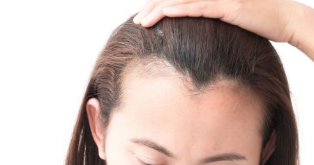 علاج لتساقط الشعر وتكثيفه.. تعرف على مختلف الطرق الطبيعية والطبية