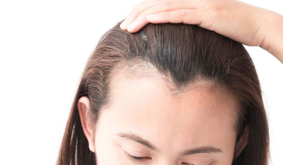 علاج لتساقط الشعر وتكثيفه