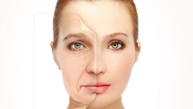 تجربتي مع شد الوجه بالخيوط