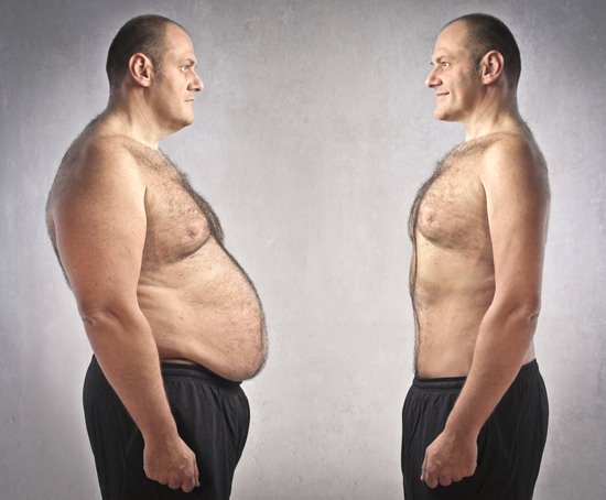 بالصور عملية شفط الدهون 7 fat vs thin man