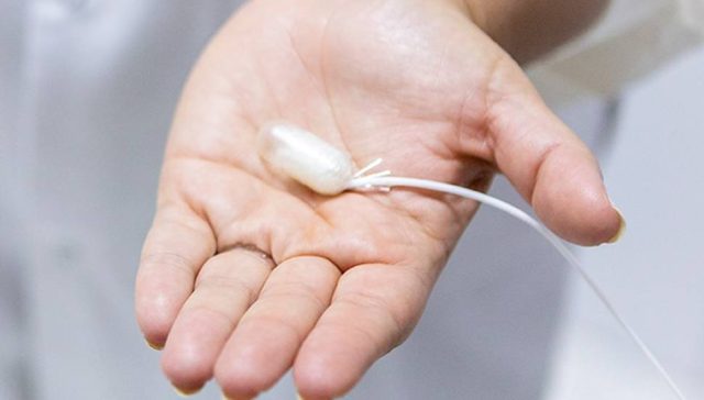 كبسولة بالون المعدة