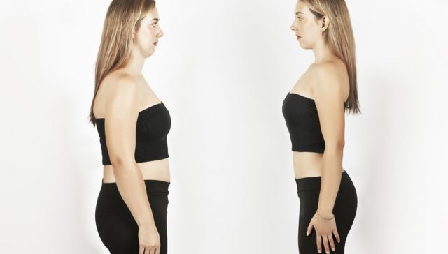 تجارب بوتكس المعده