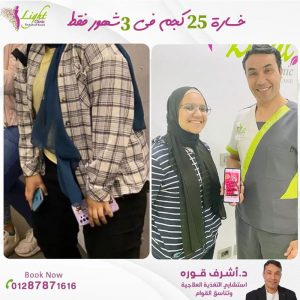 خسارة-25-كيلو-في-3-شهور