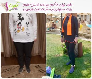 نزول 18 كيلو بنظام غذائي وميزوثيرابي وتفتيت دهون