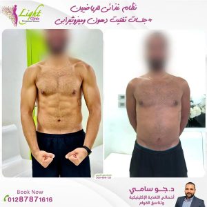 نظام غذائي للرياضيين مع جلسات تفتيت دهون وميزوثيرابي