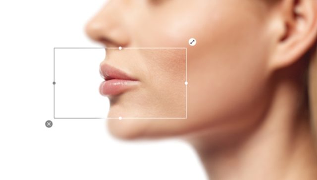 الأكل بعد فيلر الشفايف