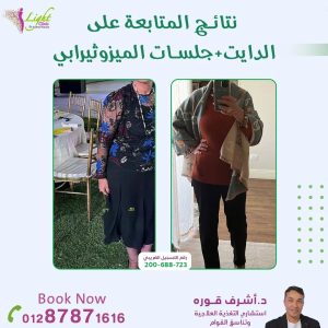 دايت وجلسات ميزوثيرابي