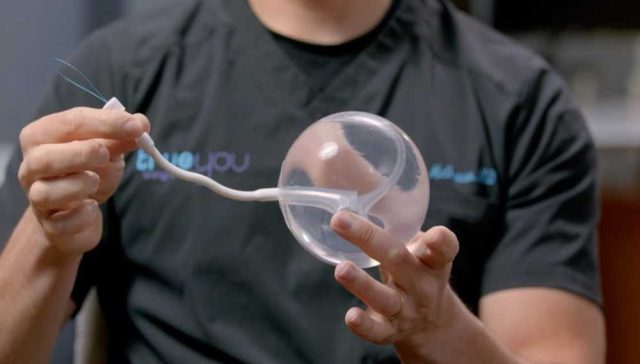 ارخص سعر لعملية بالون المعدة