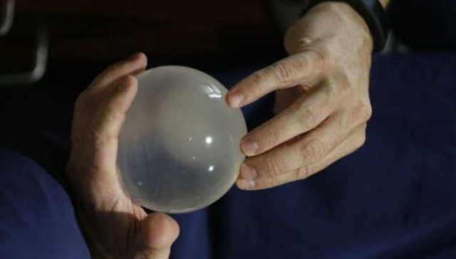 مخاطر بالون المعدة