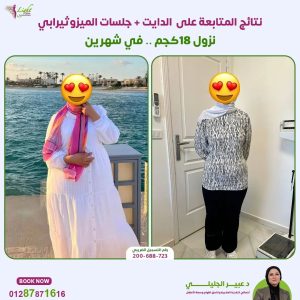 نتائج الدايت وجلسات الميزوثيرابي