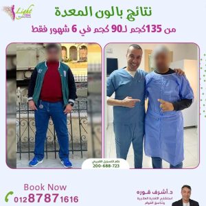 افضل عمليه للسمنه| 5 أنواع مختلفة بالمميزات والأضرار 10 نتائج بالون المعدة