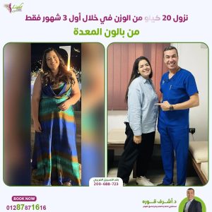 أفضل عمليات التخسيس بدون جراحة لعام 2024 6 نتائج بالون المعدة وخسارة 20 كيلو