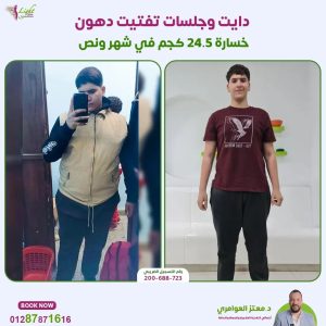 نتائج دايت وجلسات تفتيت الدهون
