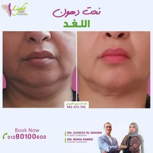 نتائج نحت اللغد