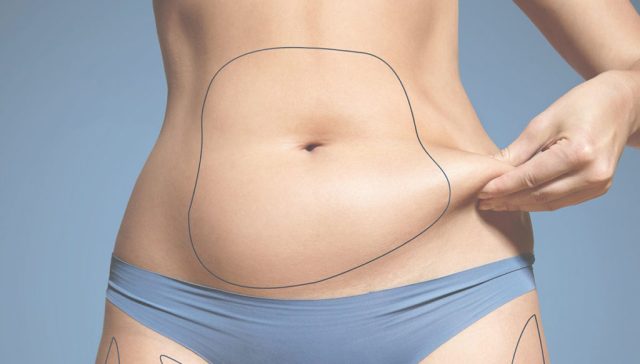 بوتوكس المعدة للتنحيف