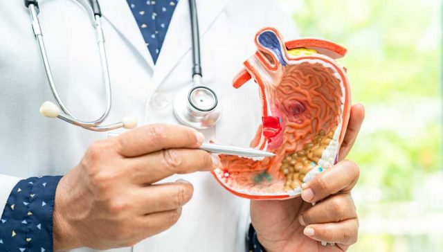 بالون المعدة في مصر