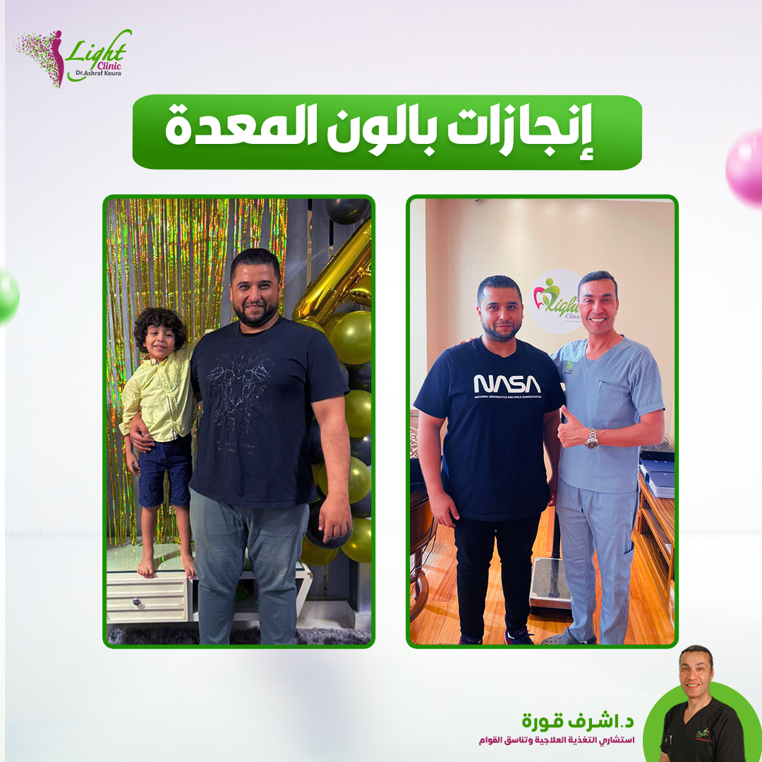 إنجازات بالون المعدة مع لايت كلينك