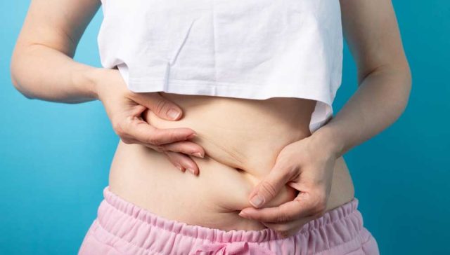 التحجر بعد شفط الدهون