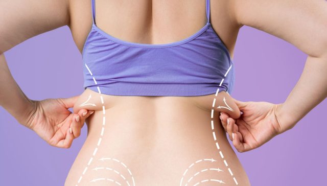 شفط دهون الظهر بالفيزر