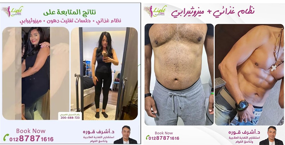 دكتور أشرف قورة استشاري التخسيس والتغذية وتنسيق القوام 9 نتائج المتابعة مع دكتور أشرف قورة