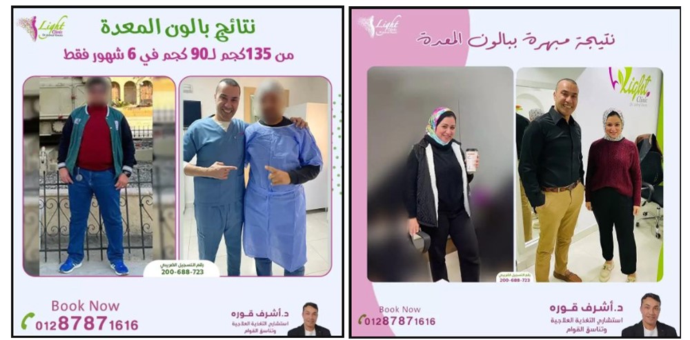 دكتور أشرف قورة استشاري التخسيس والتغذية وتنسيق القوام 10 من نتائج المتابعة مع دكتور أشرف قورة