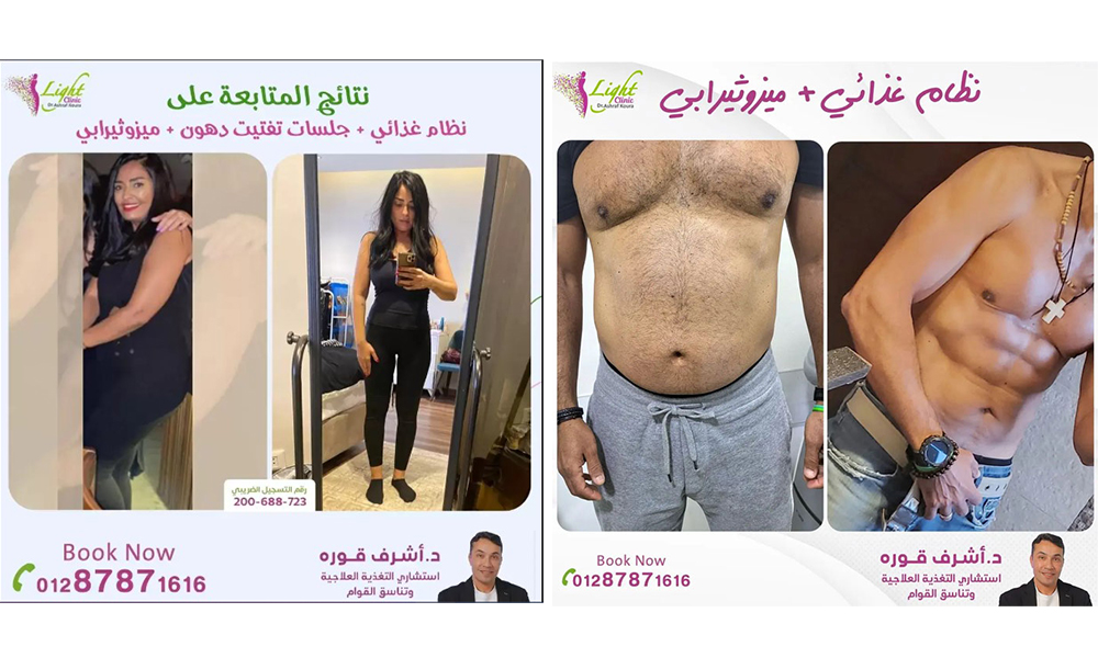 دكتور أشرف قورة استشاري التخسيس والتغذية وتنسيق القوام 3 نتائج الحالات مع دكتور أشرف قورة