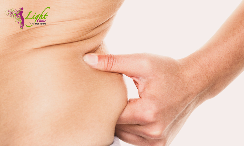 التخلص من الدهون أسفل الظهر