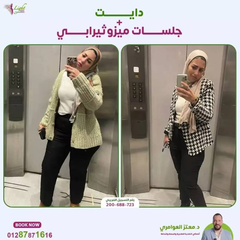 هل حقن الميزوثيرابي للتخسيس نتائجها دائمة؟ | لايت كلينك 3 من تجارب حقن الميزوثيرابي للتخسيس